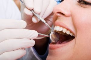 Dental Insurance in Elmwood, Peoria, Galesburg, Peoria County, Illinois